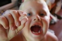 1424245378 krishatsya zubi u dtey Кришаться зуби у дітей, причини, лікування.