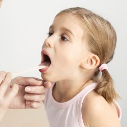  Чим лікувати горло дитині