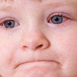  Коньюктівіт у дітей: лікування, симптоми