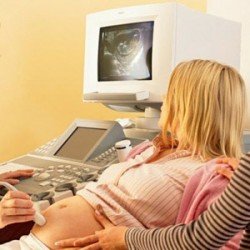  Узд на ранніх термінах вагітності