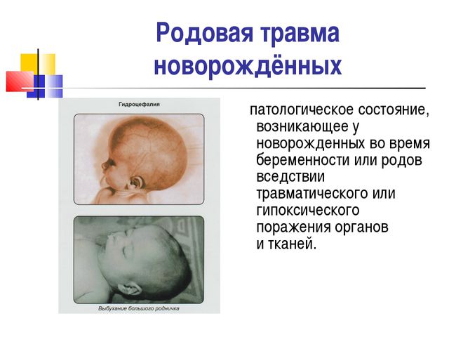 22af51a9d9f1047ef7b86cdfe26ed30f Родова травма у новонароджених (голови, шиї, хребта)