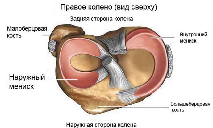49c714d991b267c5e8995aad10640778 Розрив заднього рогу медіального меніска колінного суглоба: лікування, операція