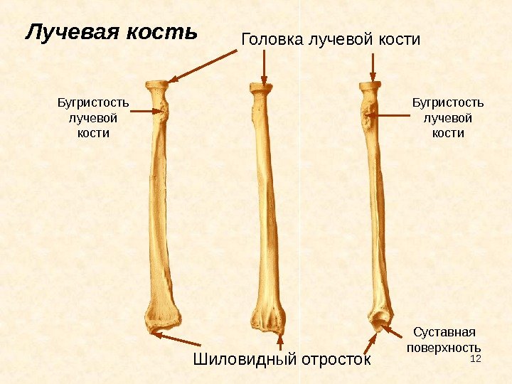 a1058c713ba47e6a539c3a4f055f3dc3 Перелом променевої кістки руки зі зміщенням: лікування, термін зрощення