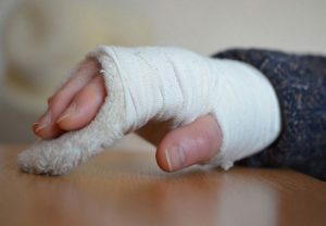 b38f3be9316dcd674546e7dff8ea9301 Перелом руки зі зміщенням: скільки носити гіпс, лікування