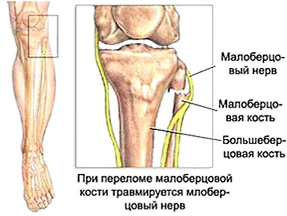 c001bbcb4cc84e7a345d573a8f01f726 Чому терпне нога від стегна до стопи. Причини і лікування оніміння ніг