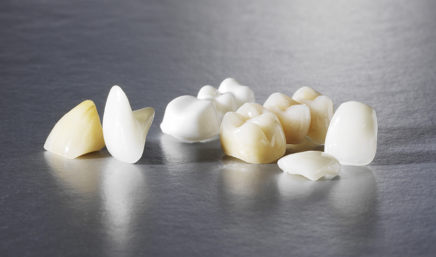 58026487bce6fb78e084e1dbdae844b6 Які зуби краще вставляти пластмасові або керамічні: відмінність, ціна, характеристики