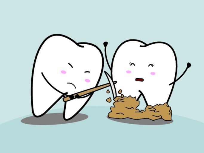  Як зняти зубний камінь в домашніх умовах: домашнє засіб, лікування, швидко, чистка