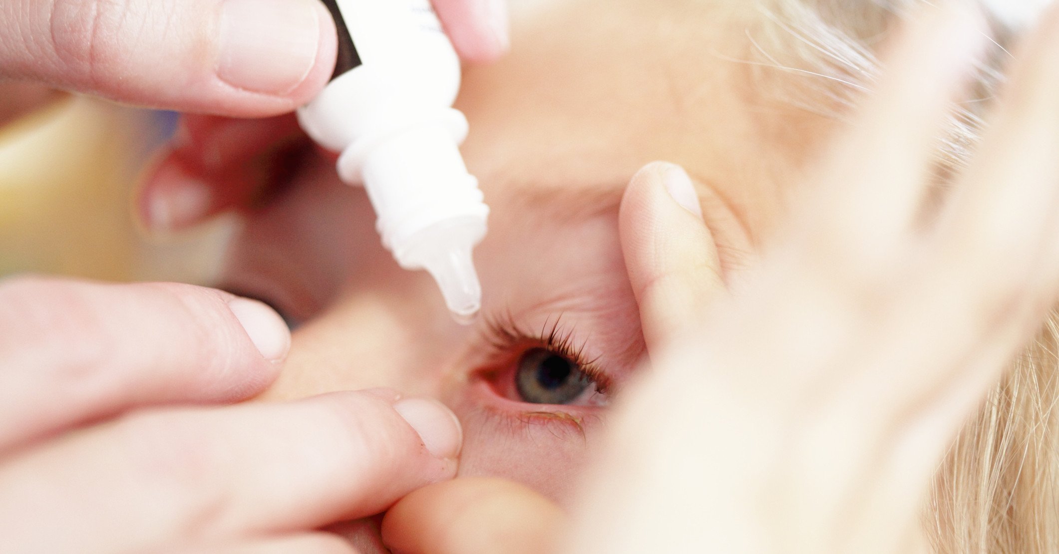  Протиалергічні краплі для очей для дітей: список відгуки