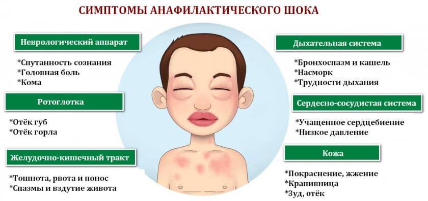 852ccd45debf98aeea5659ccb0e3675c Алергія на фундук: може виникати симптоми у дорослих і дітей, алергія на пилок